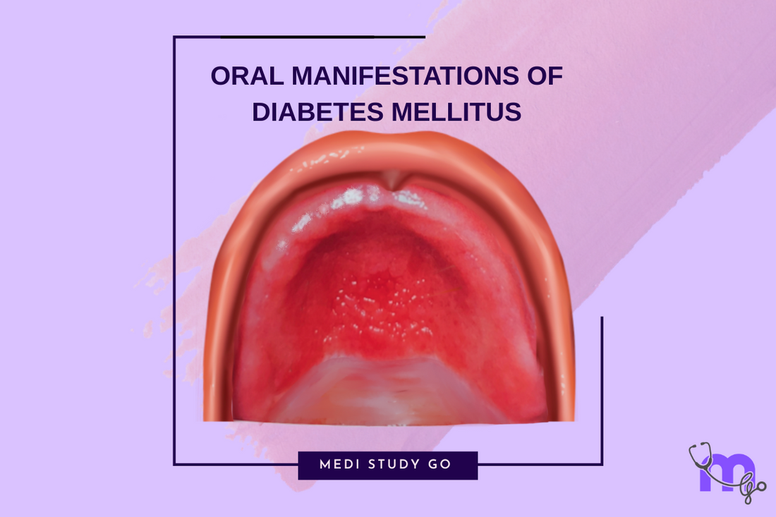 Oral Manifestations