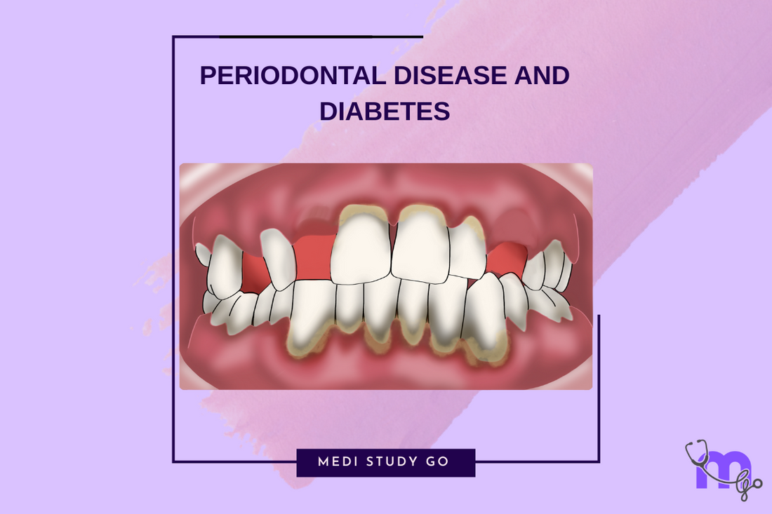 Periodontal Disease and Diabetes