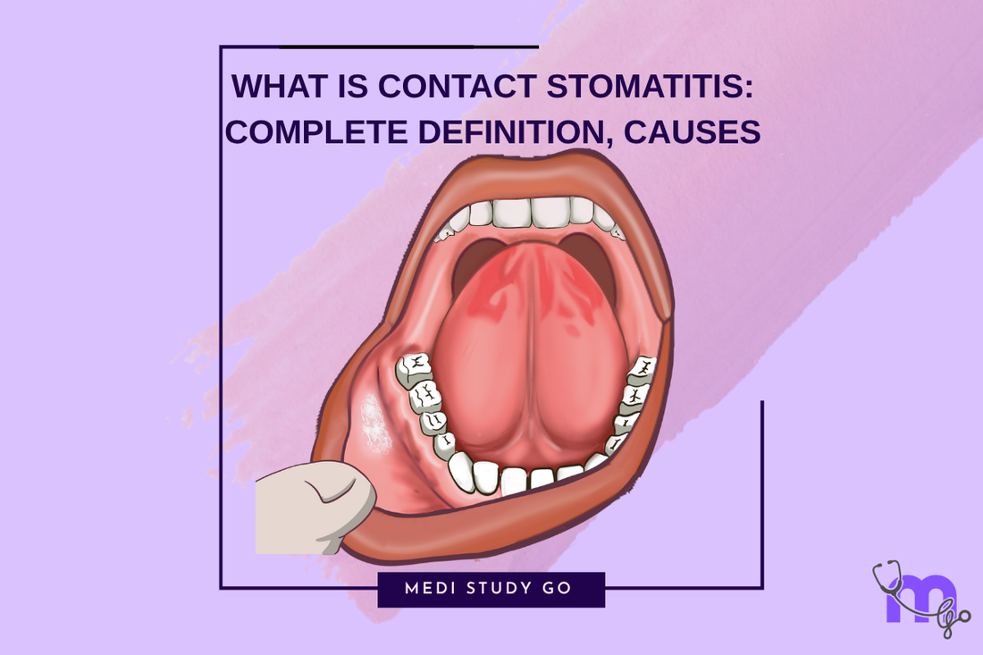 Contact Stomatitis