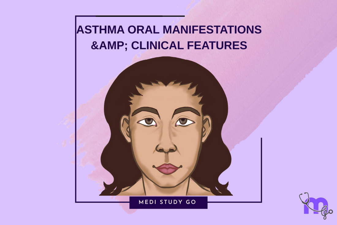 Asthma Oral Manifestations Clinical Features