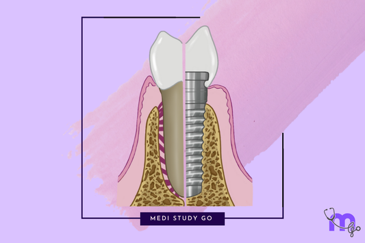 Implant Fixed dental support