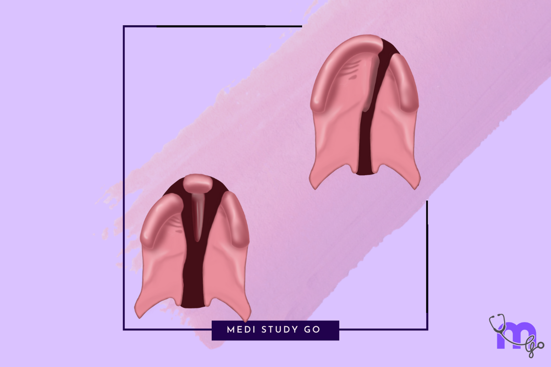 Veau’s Classification