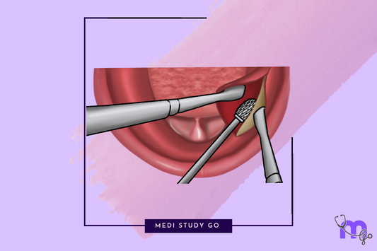 Preprosthetic Surgery