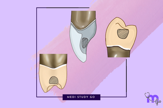 Design consideration