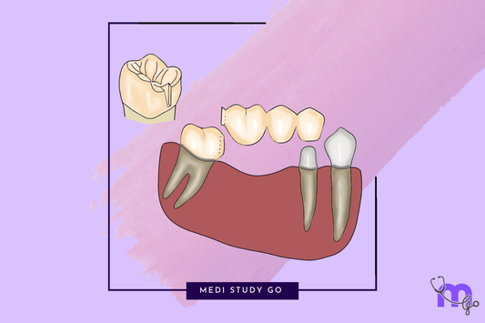 Pontics classification