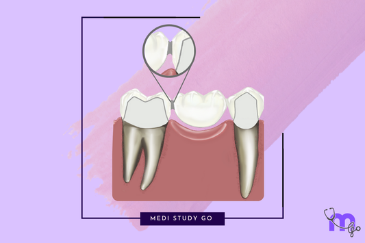 Functional Requirements of Pontics