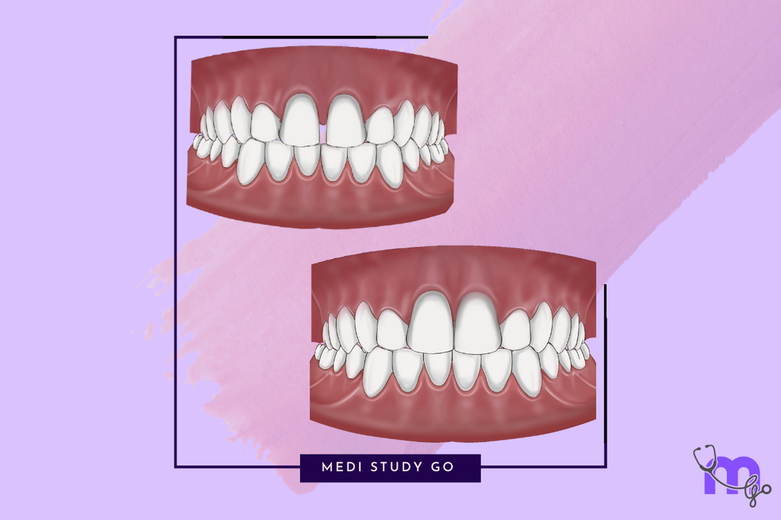 Clinical Applications of Dental Composites: A Comprehensive Guide