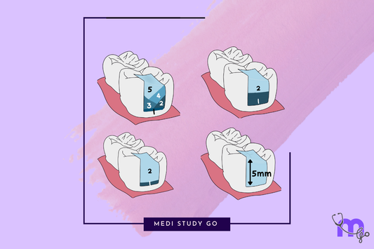 Bulk-Fill Composites