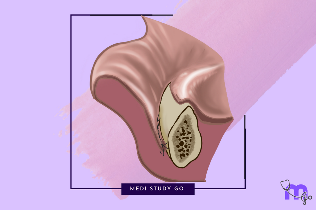 Preprosthetic Surgery