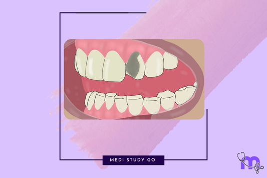 Metal-Ceramic Systems and Ceramic Failures