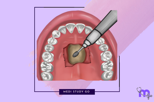 Preprosthetic Surgery