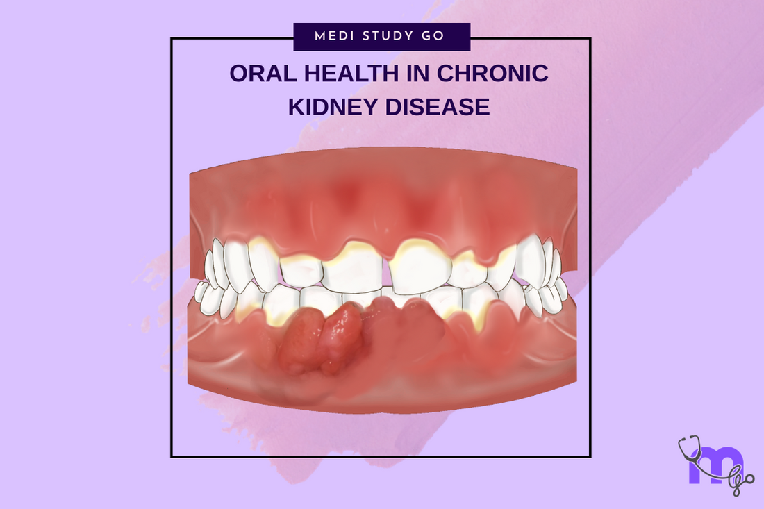 Oral Health in Chronic Kidney Disease