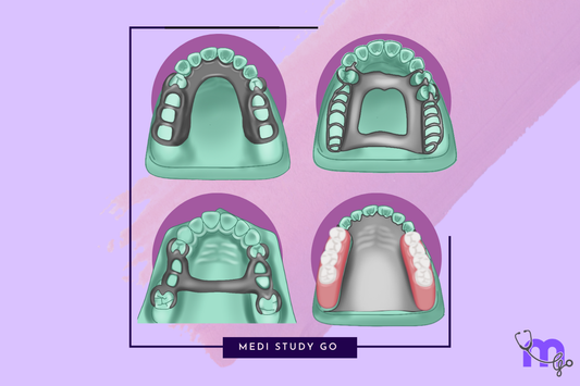 Types of Maxillary Major Connectors