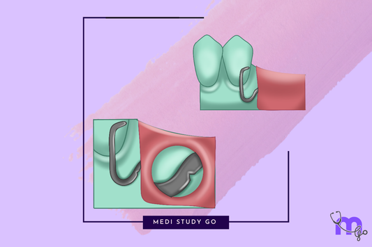 Types of Minor Connectors