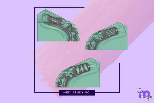Minor Connectors in Prosthodontic
