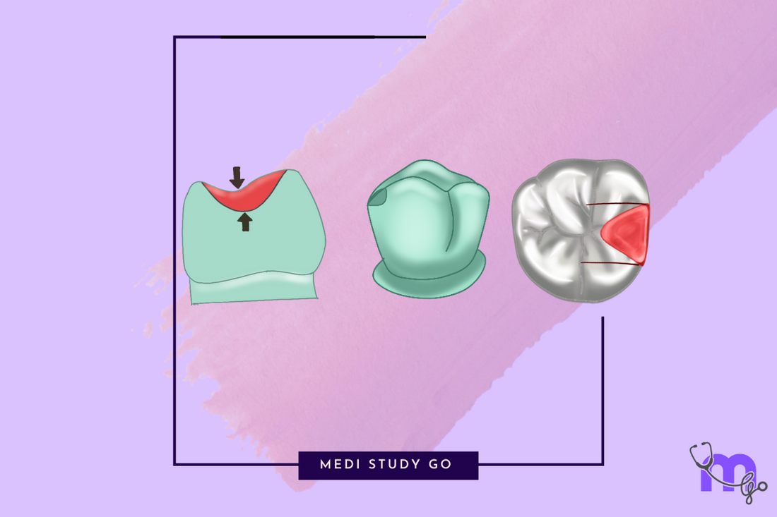 Types of Rest Seats