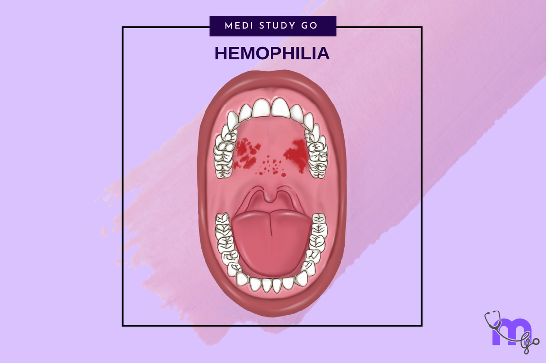 Hemophilia and Dental Considerations