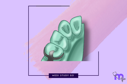 Rest Seat Preparation