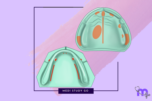 Basic Principles of Relief Design