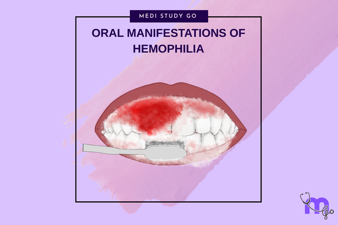 Oral Manifestations of Hemophilia