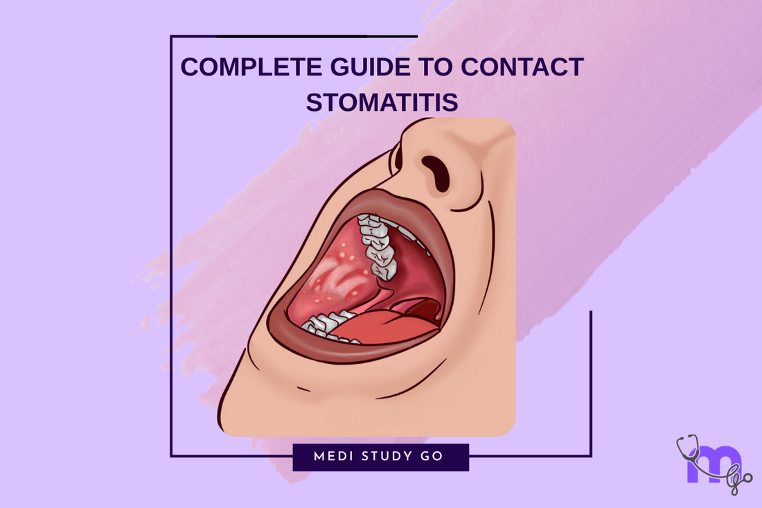 Complete Resource for Contact Stomatitis