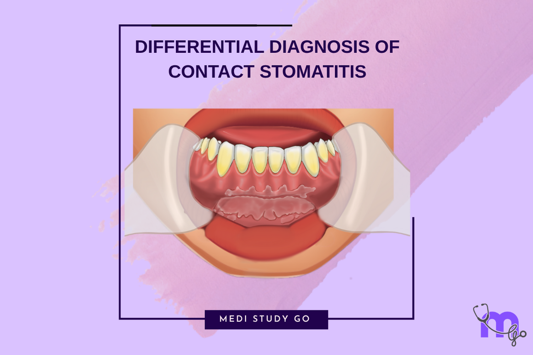 Differential Diagnosis of Contact Stomatitis