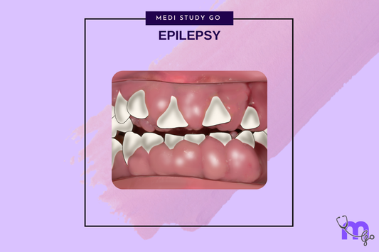 Epilepsy