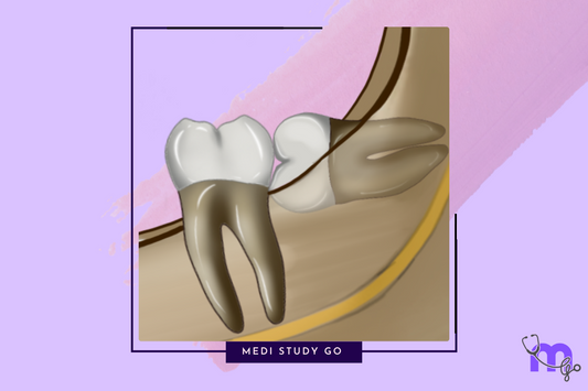 Impaction