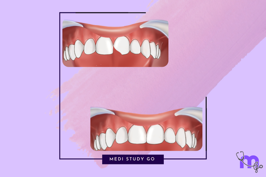 Dental composites