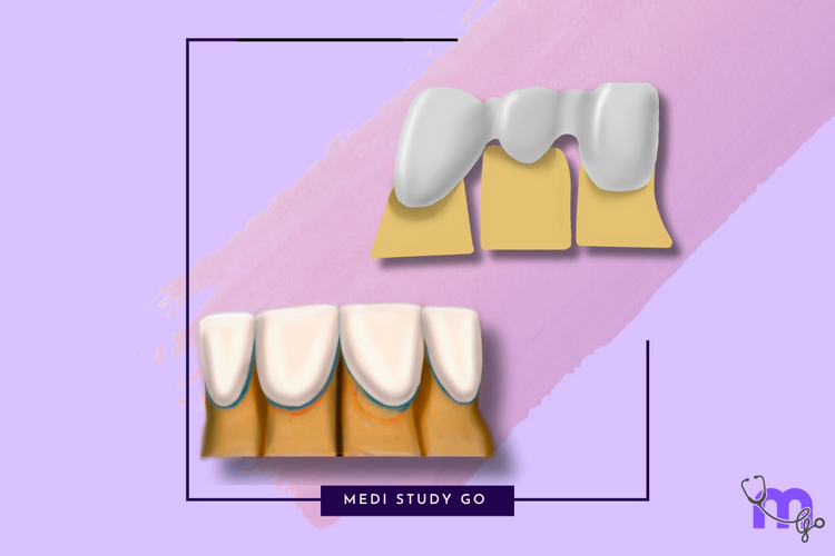 Clinical Applications of Dental Ceramics – Medi Study Go