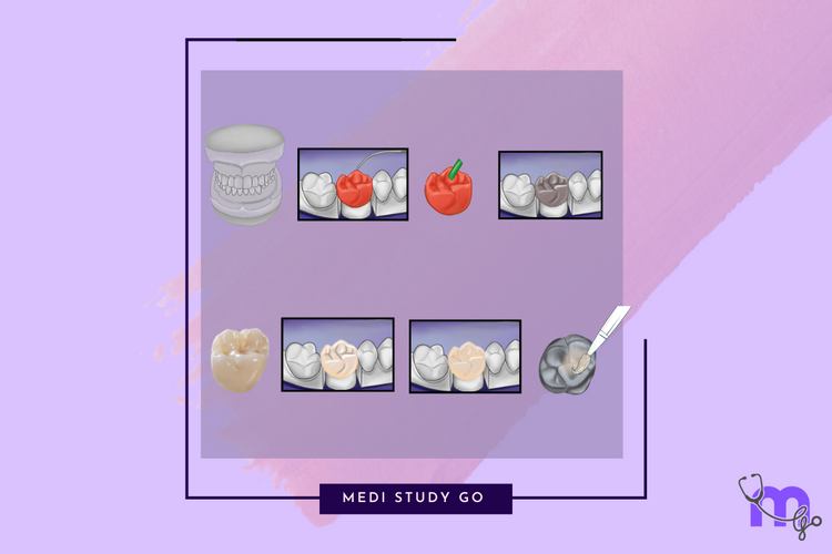 Fabrication Techniques for Dental Ceramics – Medi Study Go