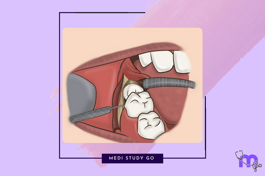 Impaction