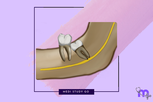 Impaction
