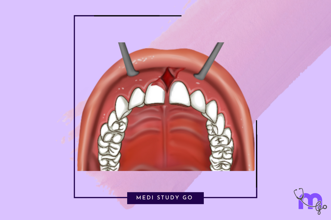 Preprosthetic surgery