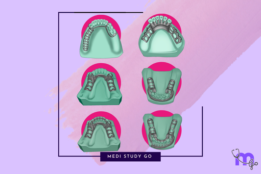 Mandibular Major Connectors