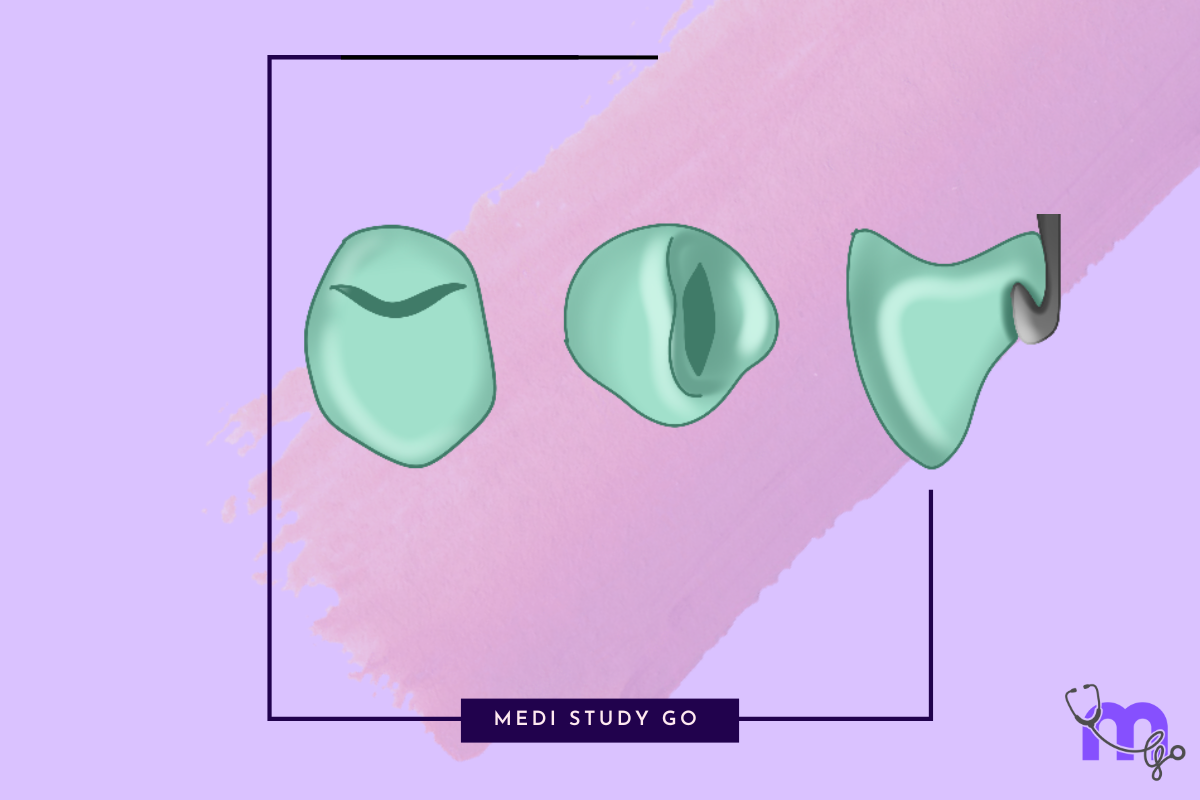 Complete Guide to Rest and Rest Seats in Removable Partial Dentures ...