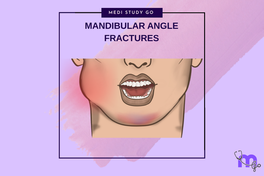 FRACTURES