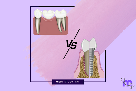 Two Paths to Tooth Replacement