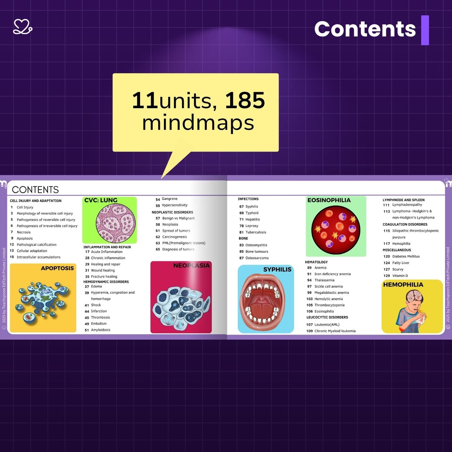 2nd yr BDS (Micro, Gpath, DM Mind maps + Pharmac Flashcards)